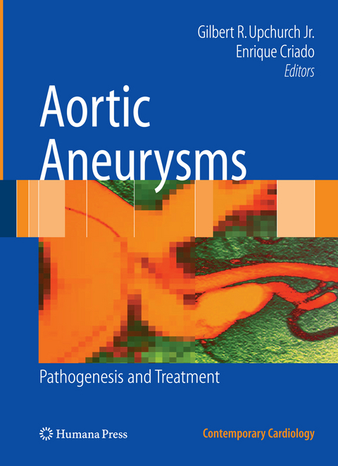 Aortic Aneurysms - 