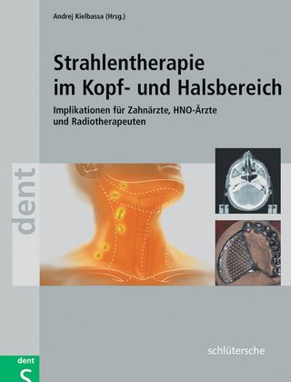 Strahlentherapie im Kopf- und Halsbereich