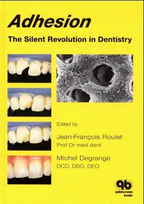 Adhesion