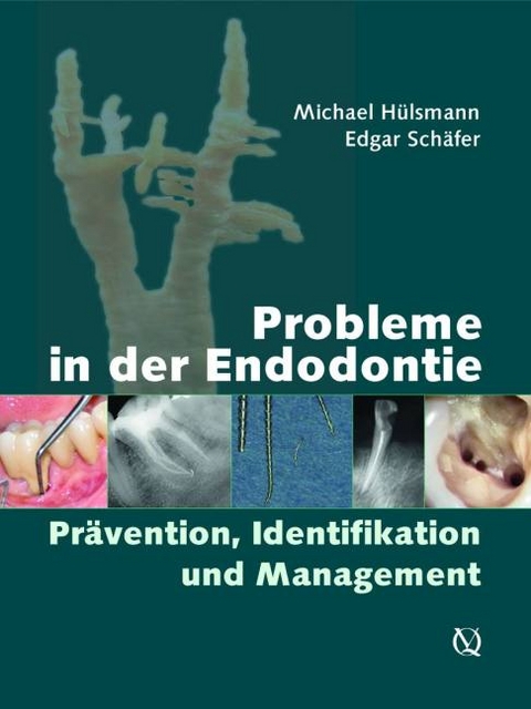 Probleme in der Endodontie - 