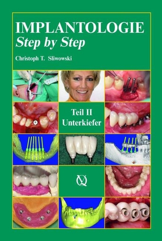 Implantologie Step by Step