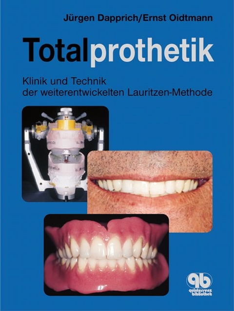Totalprothetik - J&uuml;rgen Dapprich, Ernst Oidtmann