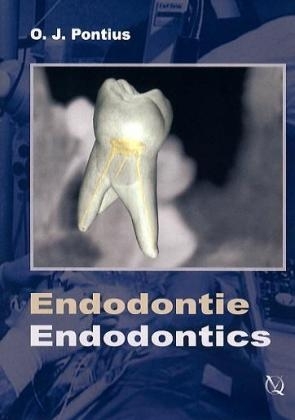 Endodontie, 1 DVD -  Pontius