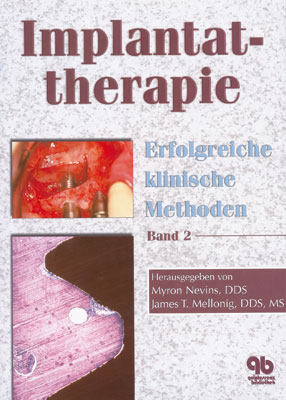 Implantattherapie - 