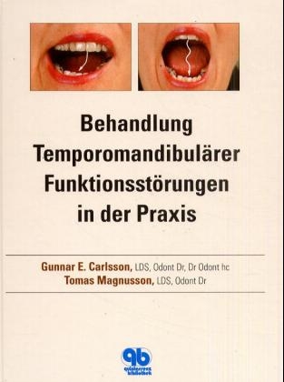 Behandlung Temporomandibulärer Funktionsstörungen in der Praxis
