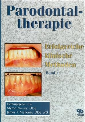 Parodontaltherapie. Erfolgreiche klinische Methoden / Parodontaltherapie