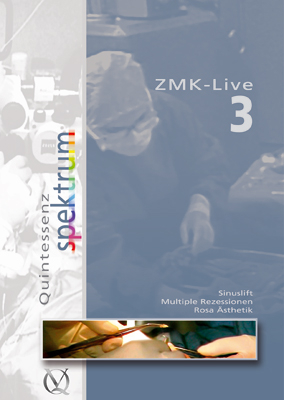 ZMK-Live 3