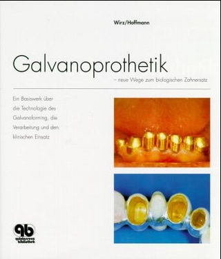 Galvanoprothetik