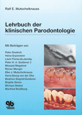 Lehrbuch der klinischen Parodontologie - Ralf E. Mutschelknau&szlig;