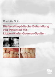 Kieferorthop&auml;dische Behandlung von Patienten mit Lippen-Kiefer-Gaumen-Spalten - Charlotte Opitz