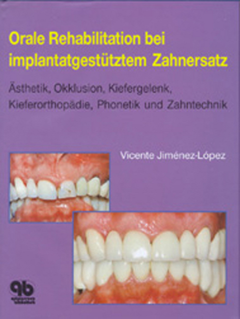 Orale Rehabilitation bei implantatgest&uuml;tztem Zahnersatz - Vicente Jim&eacute;nez-L&oacute;pez