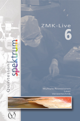 ZMK-Live 6