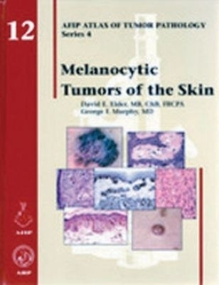 Melanocytic Tumors of the Skin - David E. Elder, George F. Murphy