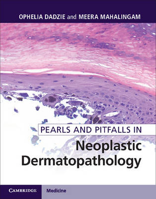 Pearls and Pitfalls in Neoplastic Dermatopathology