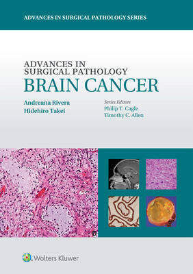 Advances in Surgical Pathology: Brain Cancer