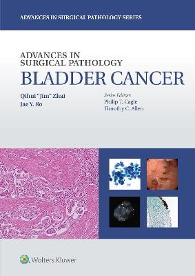 Advances in Surgical Pathology: Bladder Cancer - Qihui &ldquo;Jim&rdquo; Zhai, Dr. Jae Y. Ro