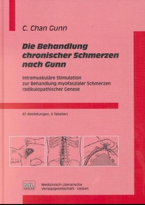 Die Behandlung chronischer Schmerzen nach Gunn