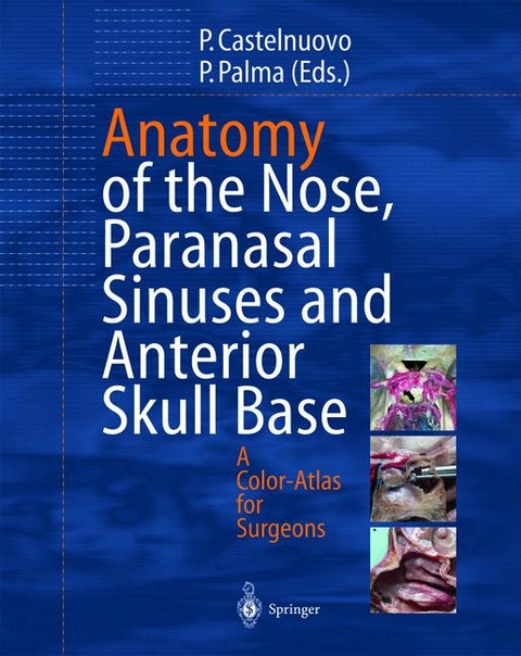 Anatomy of the Nose, Paranasal Sinuses and Anterior Skull Base - 