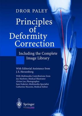 Principles of Deformity Correction - Dror Paley