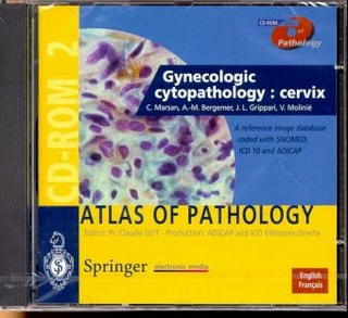 Gynecologic cytopathology: Cervix
