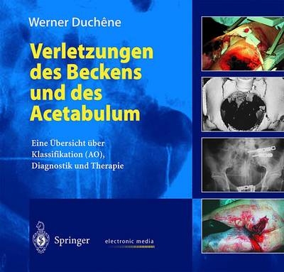 Verletzungen des Beckens und des Acetabulum - W. Duchene