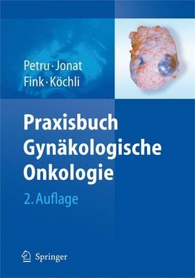 Praxisbuch Gyn&auml;kologische Onkologie - 