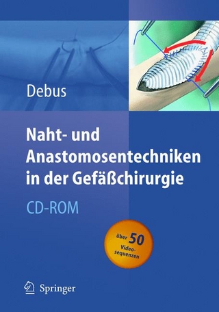 Naht- und Anastomosentechniken in der Gefäßchirurgie