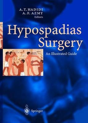 Hypospadias Surgery - 