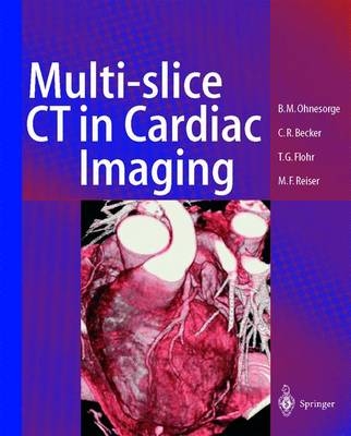 Multi-slice CT in Cardiac Imaging - Bernd M. Ohnesorge, Thomas G. Flohr, Christoph R. Becker, Maximilian F. Reiser