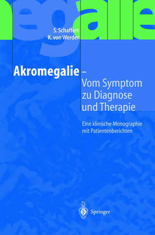 Akromegalie — Vom Symptom zu Diagnose und Therapie