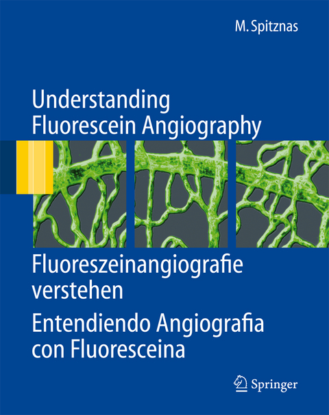 Understanding Fluorescein Angiography, Fluoreszeinangiografie verstehen, Entendiendo Angiograf&iacute;a con Fluoresce&iacute;na - Manfred Spitznas