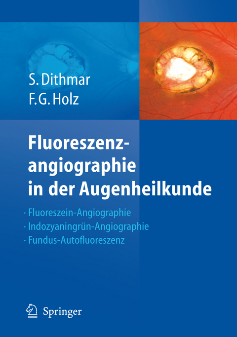 Fluoreszenzangiographie in der Augenheilkunde - Stefan Dithmar, Frank G. Holz