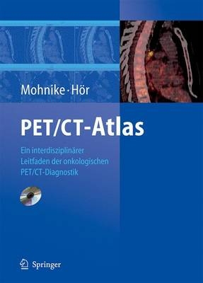 PET/CT-Atlas