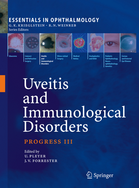 Uveitis and Immunological Disorders - 