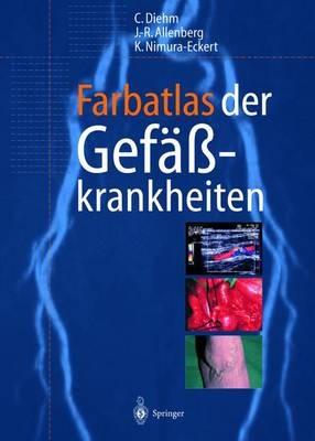 Farbatlas der Gef&auml;sskrankheiten - Curt Diehm, J. R. Allenberg, Keiko Nimura-Eckert