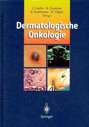 Dermatologische Onkologie - 