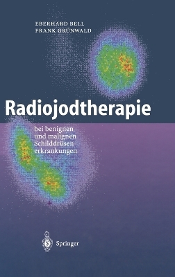 Radiojodtherapie - Eberhard Bell, Frank Gr&uuml;nwald