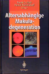 Altersabh&auml;ngige Makuladegeneration - 