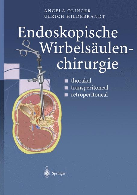 Endoskopische Wirbels&auml;ulenchirurgie - Angela Olinger, Ulrich Hildebrandt
