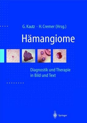 H&auml;mangiome