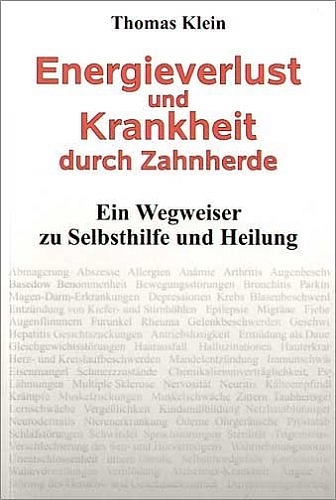 Energieverlust und Krankheit durch Zahnherde - Thomas Klein