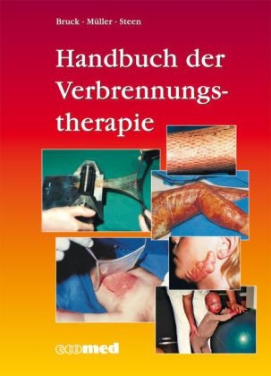 Handbuch der Verbrennungstherapie - Johannes C. Bruck, Fritz E. M&uuml;ller, Michael Steen