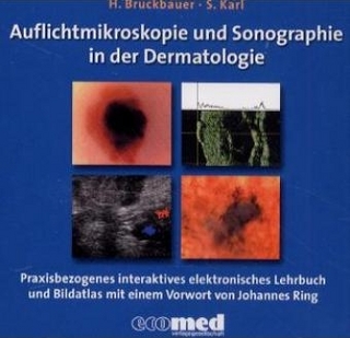 Auflichtmikroskopie und Sonographie in der Dermatologie