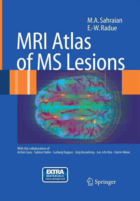 MRI Atlas of MS Lesions - M.A. Sahraian, Ernst-Wilhelm Rad&uuml;
