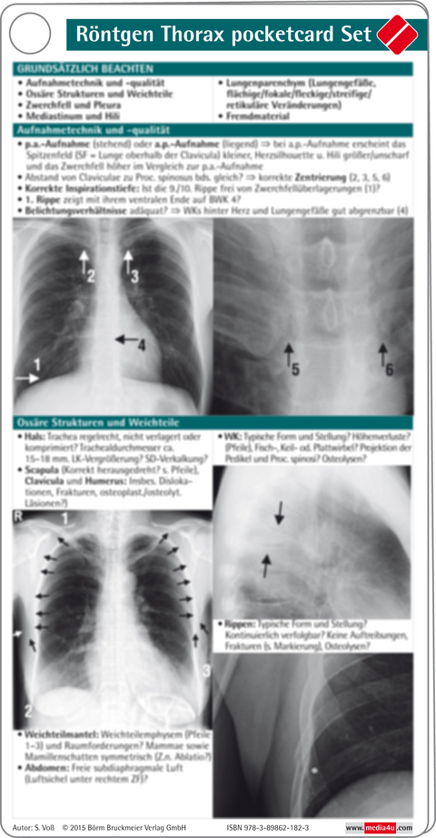 R&ouml;ntgen Thorax pocketcard Set - S. Vo&szlig;