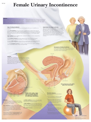 Female Urinary Incontinence