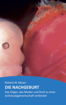 Die Nachgeburt - Roland W. Moser