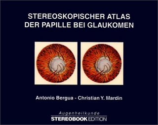 Stereoskopischer Atlas der Papille bei Glaukomen, m. Stereobrille
