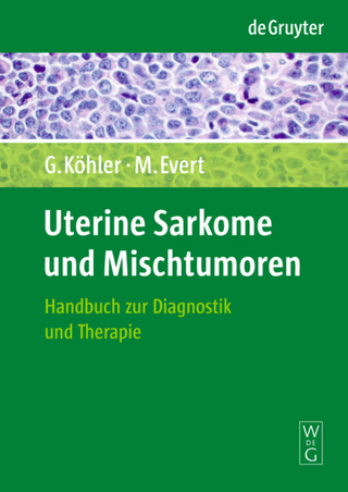Uterine Sarkome und Mischtumoren