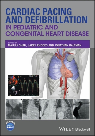 Cardiac Pacing and Defibrillation in Pediatric and Congenital Heart Disease
